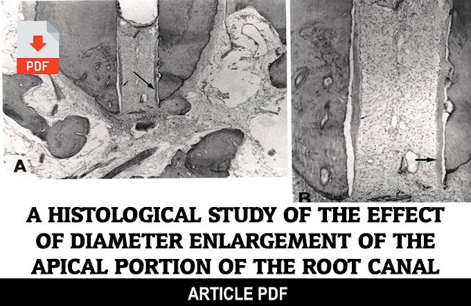 PDF: A Histological Study of the Effect of Diameter Enlargement of the Apical Portion of the Root Canal 