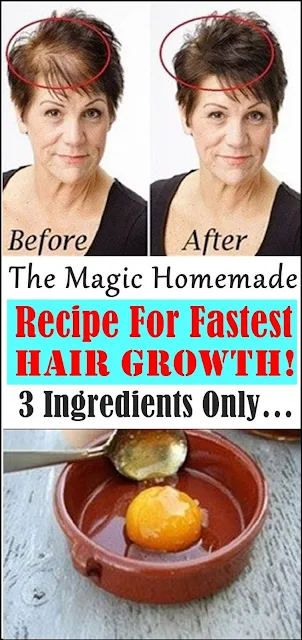 A Magic Recipe For The Fastest Hair Growth! You Only Need 3 Ingredients!