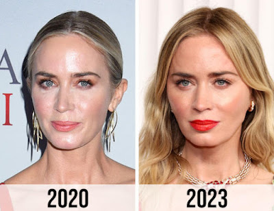 Fans Speculate That Emily Blunt Had Plastic Surgery After Her Latest Red Carpet Appearance: 'What Did She Do To Her Face And Why!'