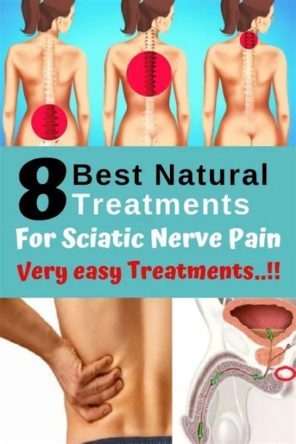 8 Best Natural Treatments For Sciatic Nerve Pain