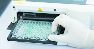 The growth of the microplate reader market will impact key players by 2026