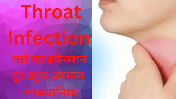 घशातील जंतुसंसर्ग (Throat Infection) Remedies: