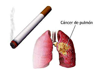 La causa de cáncer de pulmón se da por las anormalidades en las células. El cuerpo de los seres humanos regula automáticamente la producción y el crecimiento de las células cuando el cuerpo las necesita