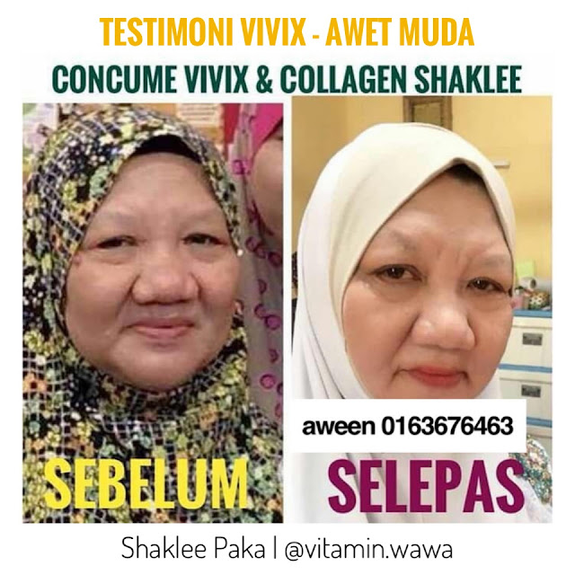 Set cantik shaklee, Set Cantik Bajet Shaklee, Set Cantik Premium Shaklee Harga set cantik shaklee Keistimewaan set cantik shaklee Cara makan set cantik shaklee ESP SHAKLEE, testimoni set cantik shaklee bebas jerawat, bebas parut, testimoni set cantik shaklee, testimoni set cantik premium  shaklee, testimoni set cantik shaklee - resv dan vivix, testimoni resv shaklee, testimoni vivix shaklee, testimoni resv shaklee untuk cantik, testimoni vivix shaklee untuk kulit cantik, testimoni set cantik shaklee,set cantik bajet shaklee  testimoni set cantik shaklee  set cantik shaklee new packaging  harga set cantik shaklee  set kulit cantik shaklee bajet  youth shaklee  set kurus shaklee  cara makan set kecantikan shaklee