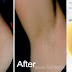 Removing Underarm Hairs In Just 2 Minutes