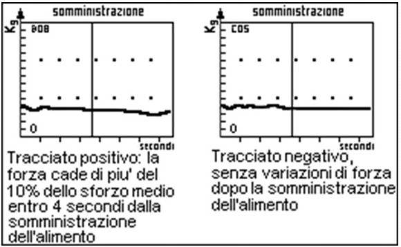 Test DRIA per le intolleranze alimentari