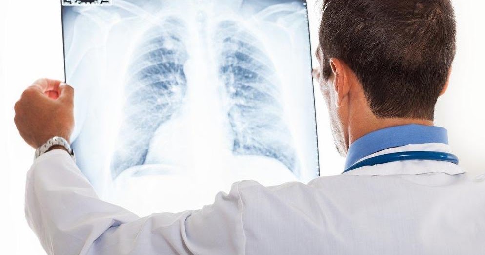 Lung Cancer Spread To Bones Life Expectancy - CancerOz