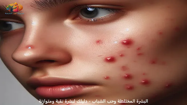 البشرة المختلطة والحبوب