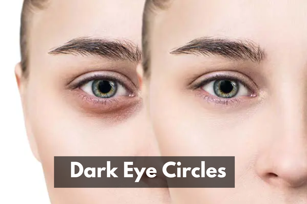 DIY Coffee Treatment for Dark Eye Circles