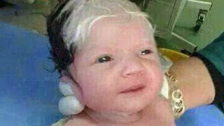 Saçları Siyah Beyaz Doğan Bebek