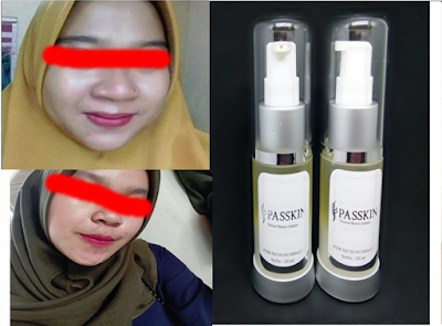 Serum yang cepat menghilangkan flek hitam dengan cepat