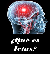 http://www.doctorcitosv.com/2015/08/ictus.html
