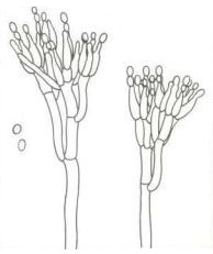 Конидиеносцы и конидии Penicillium expansum