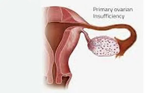 What is  Primary Ovarian Insufficiency(POI)