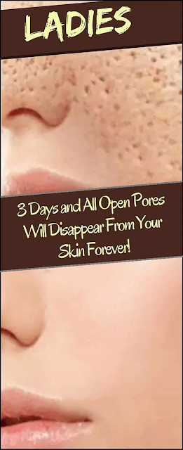 3 DAYS AND ALL OPEN PORES WILL DISAPPEAR FROM YOUR SKIN FOREVER