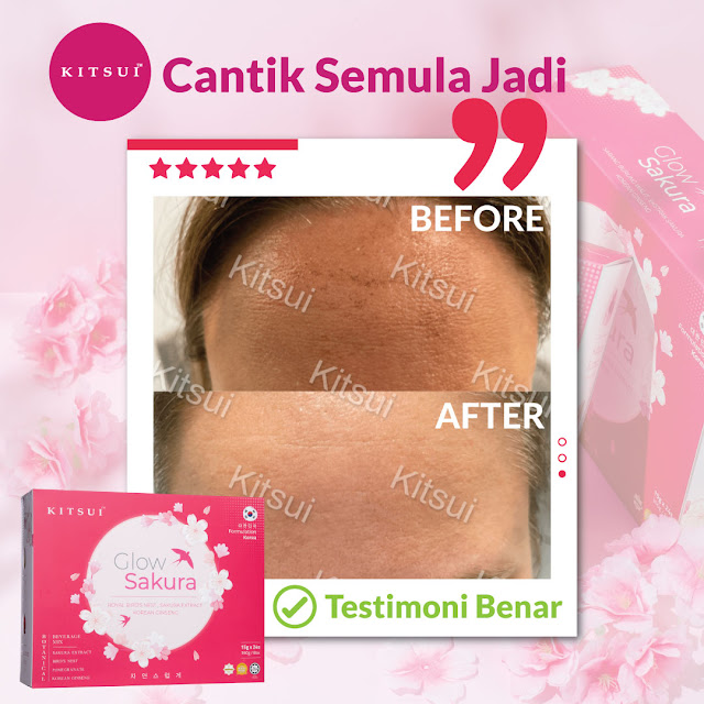 Kitsui Glow Sakura Sarang Burung Walit, Tingkatkan Aura Wajah Secara Semulajadi dengan Formulasi dari Korea, kitsui glow sakura, kitsui glow sakura review, kitsui Malaysia, kejelitaan kulit bermula dari dalaman, kitsui Korean whitie, produk kitsui untuk kurus dan putih, kitsui Korean white side effect, kitsui Korean white review, produk kitsui bahaya, pantang larang kitsui Korean white, kitsui Korean white review Malaysia, kitsui Korean white and tomato review, jdt blogger, kitsui bird nest, kitsui product, kitsui review, kitsui malaysia review, kitsui malaysia testimoni, kitsui watsons Malaysia, kitsui new launch, kitsui glow sakura sarang burung walit, kitsui glow sakura royal bird nest