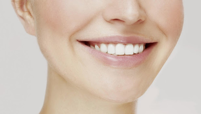 dientes blancos de forma natural