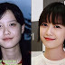 Goo Hye Sun Operasi Plastik Hidung dan Mata