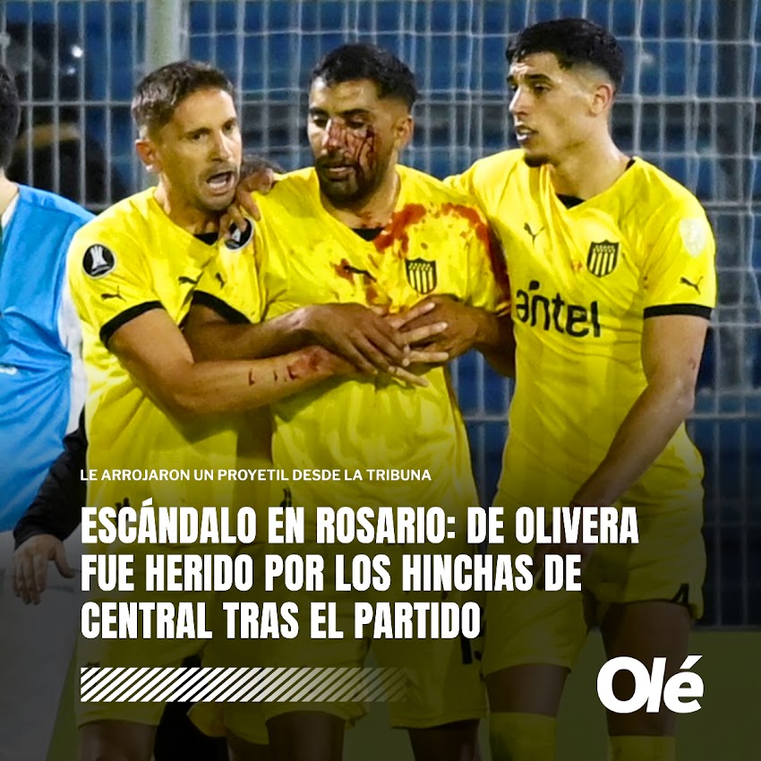  Maxi De Olivera, jugador de Peñarol fue impactado con una piedra en su rostro por hinchas de Central.