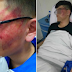 Student Lands In A Hospital After Receiving ‘Hot’ Slap From His Teacher 