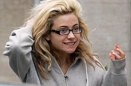 Ugly Photos Celebs on Pixie Lott Is An Extremely Beautiful And Talented Girl  Is Acne