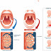 Should I Go To Doctor After Tonsil Stone