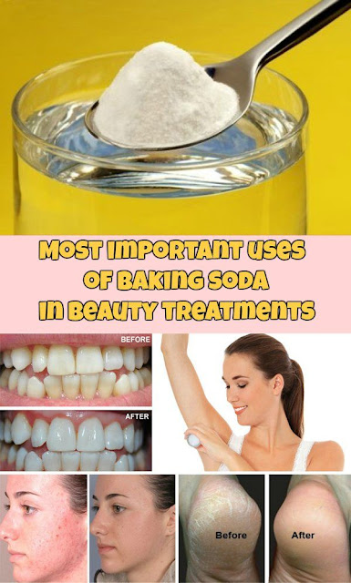 Most important uses of baking soda in beauty treatments