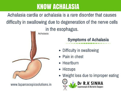 http://www.laparoscopicsolutions.in/Achalasia-Cardia.html