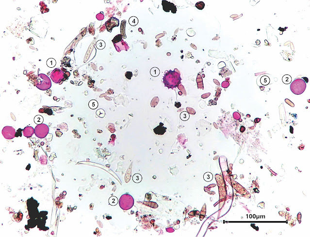 Air sample at 200x magnification showing pollen, fungal spores and fragments, and starch grains 01