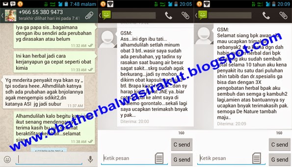 gejala ambeien, gejala wasir, obat alami ambeien, obat ambeien, obat ambeien alami, obat ambeien tanpa operasi, obat herbal ambeien, obat herbal wasir, obat wasir, obat wasir alami, 