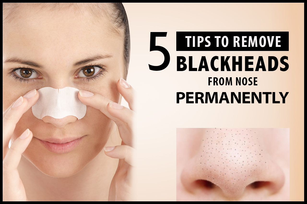 The right way to remove blackheads at home FOOD