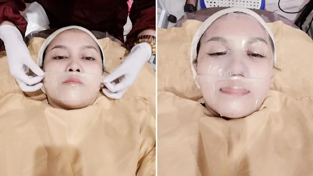 bright-booster-laser-ella-skincare-solo