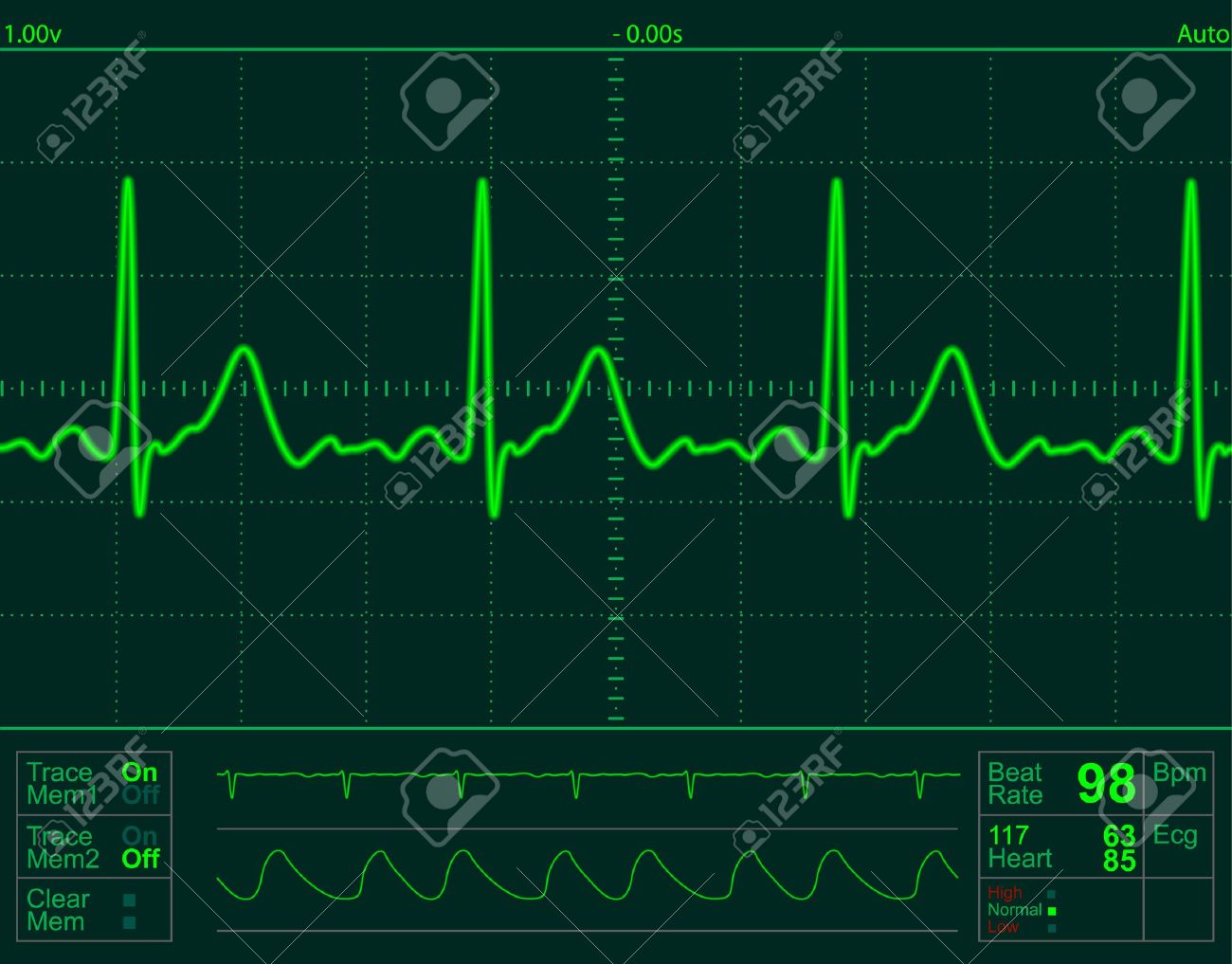 Heart Rate Monitor