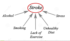 What is stroke, causes, symptoms and treatment 