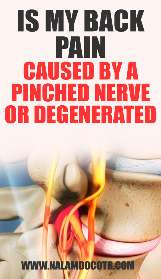 Is My Back Pain Caused by a Pinched Nerve or Degenerated Disc?