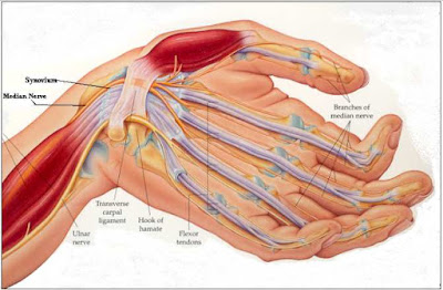 Guillain Barré Syndrome