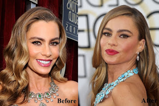 Sofia Vergara Plastic Surgery Before And After Photo