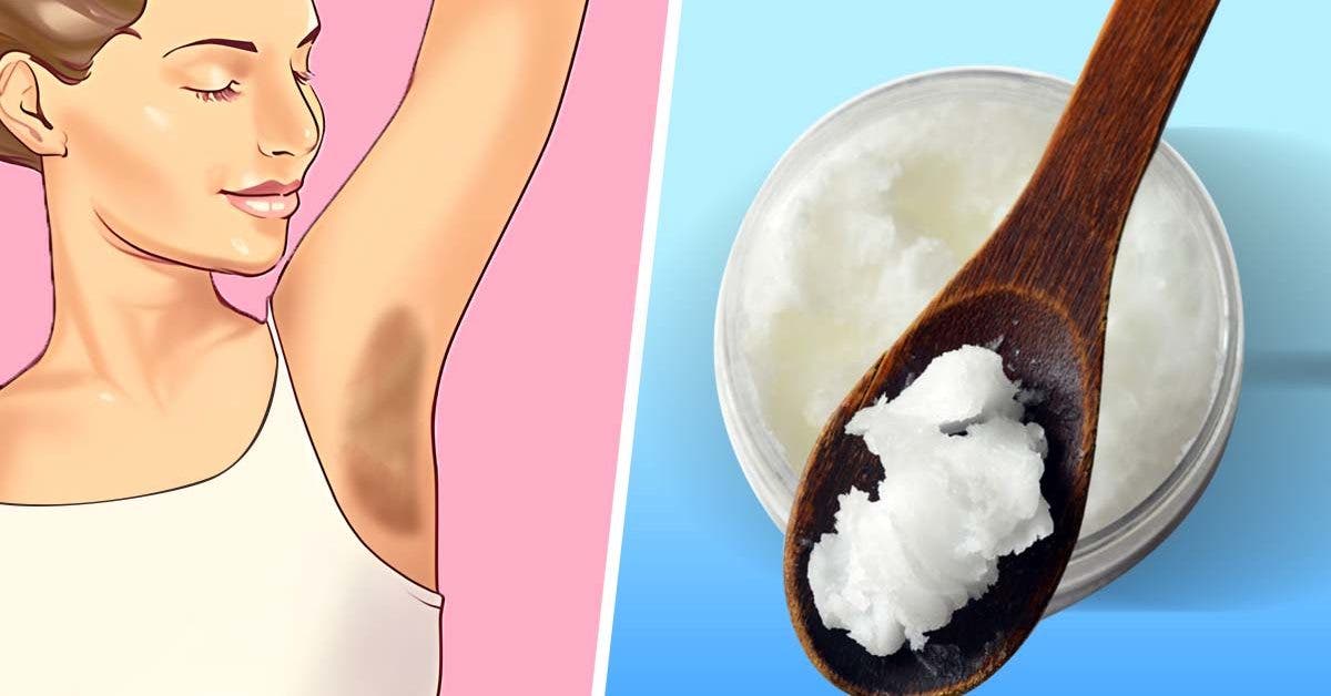  How To Lighten Dark Underarms Naturally?