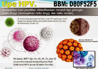 obat kutil - di kulit kemaluan kelamin, penis pria laki-laki, vagina luar dan dalam, perempuan wanita Ibu hamil menyusui mengandung, obat penghilang kutil menghilangkan kutil tanpa operasi yang terbukti dan aman terpercaya, obat penghilang kutil di kelamin, anus dubur, paha dsb