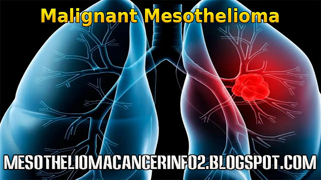 The Truth About WHAT CAUSES MALIGNANT MESOTHELIOMA? In 3 Minutes