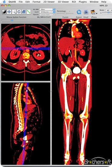 osirix-308887-1259814529