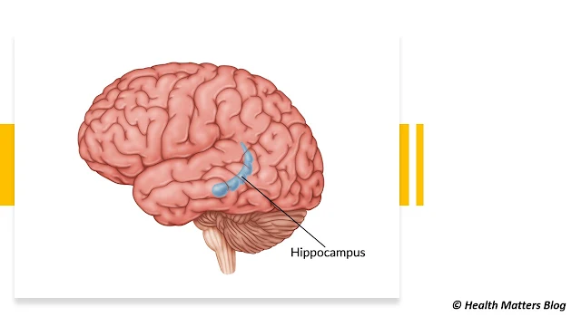 The hippocampus is a part in the brain that lies within the white matter of the temporal lobe.