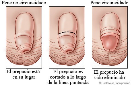 5 Formas En Las Que Puedes Quedar Embarazada Sin Penetracin