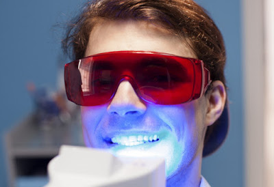 Tẩy trắng răng bằng công nghệ Laser Whitening