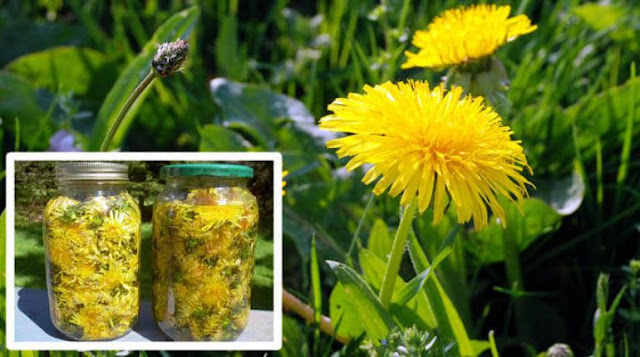 Dandelion Cures Cancer, Hepatitis, Liver, Kidneys, Stomach … Here’s How To Prepare