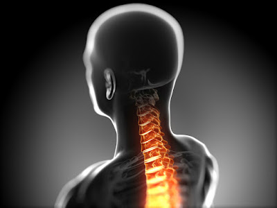 El Paso Neck Chiropractor: Spinal Cord Damage & Injury - El Paso Chiropractor