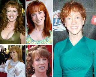 Kathy Griffin Photos Before and After