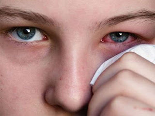 Bệnh viêm xoang hàm phải gây nguy hiểm về mắt