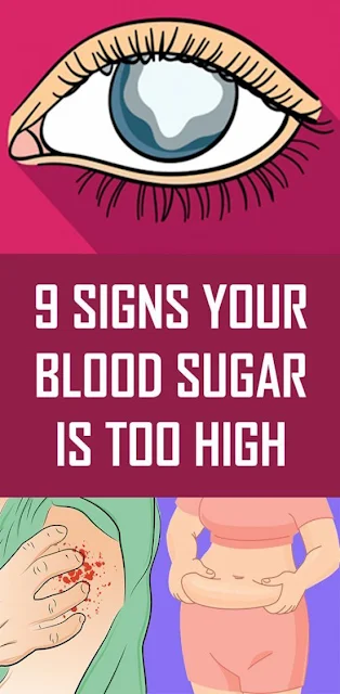 9 Signs Your Blood Sugar Is Too High