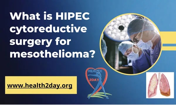 What is HIPEC cytoreductive surgery for mesothelioma?